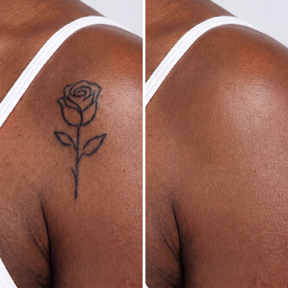Tattoos