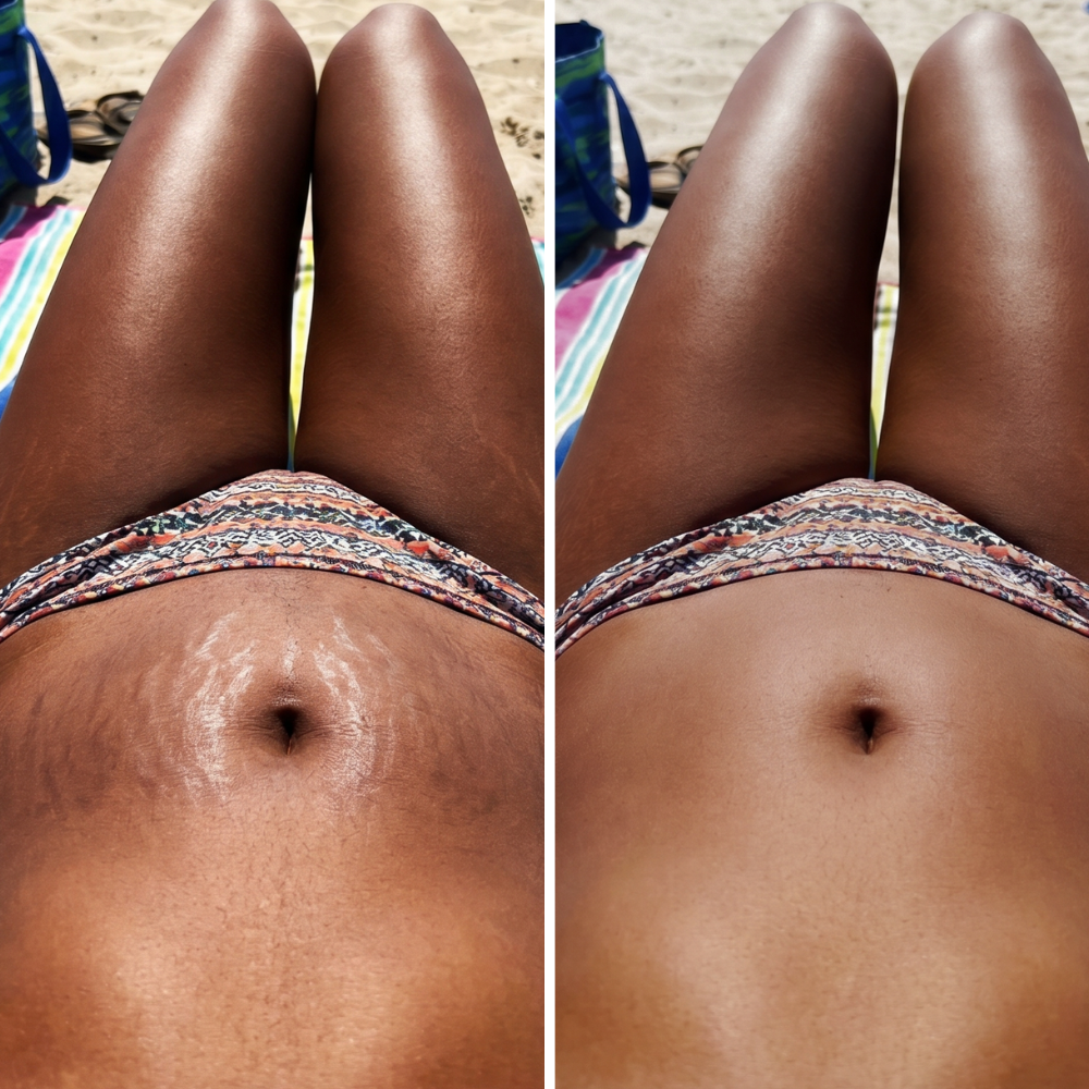 <h1>Unlock The Secret To Flawless Skin This Summer</h1>