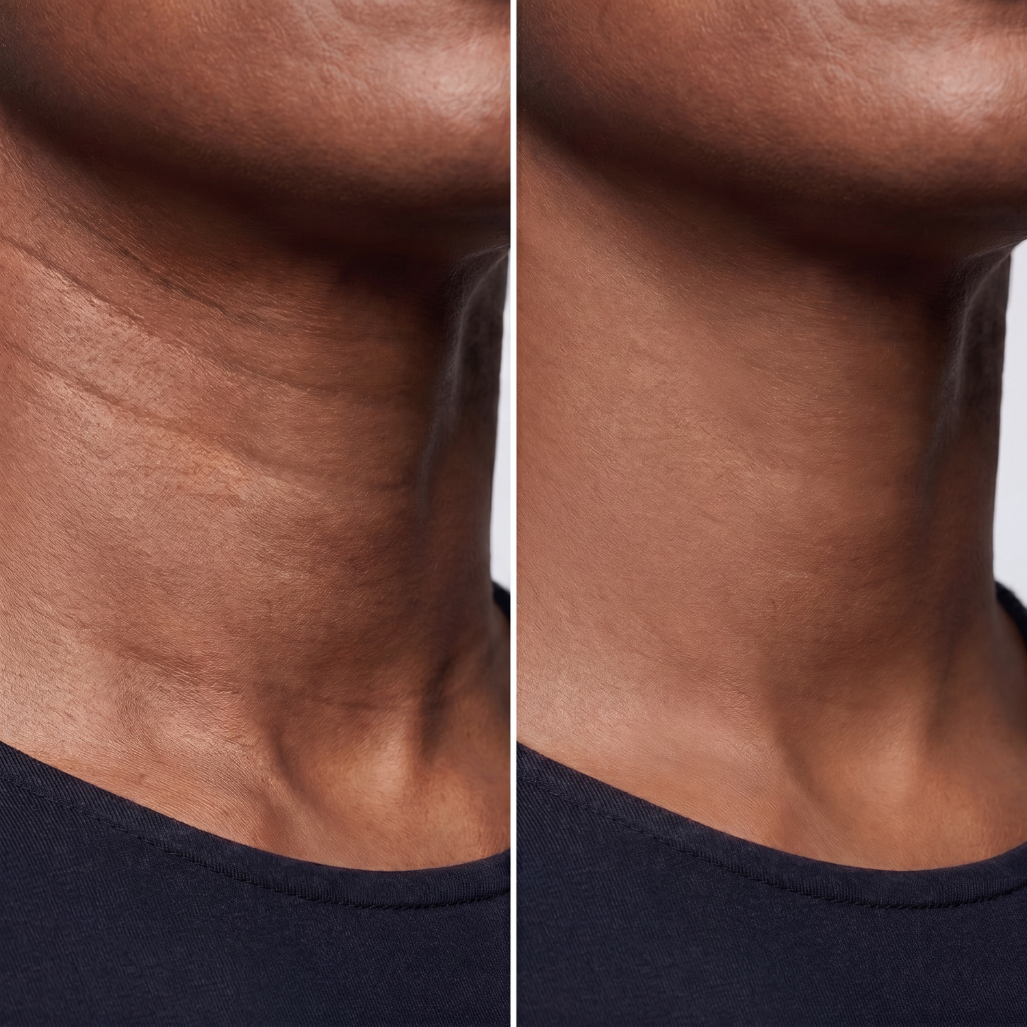 Neck Lines