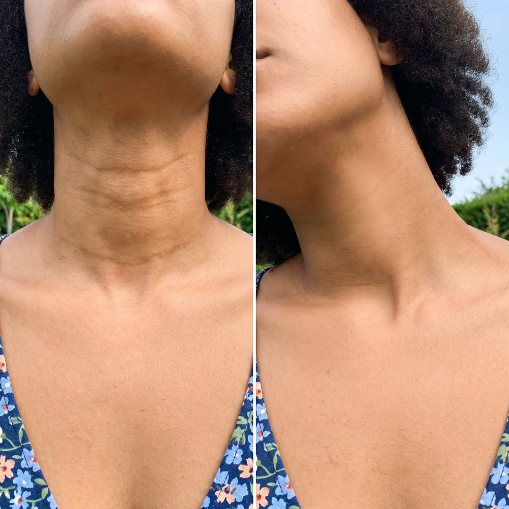 <h1>Unlock The Secret To Flawless Skin This Summer</h1>