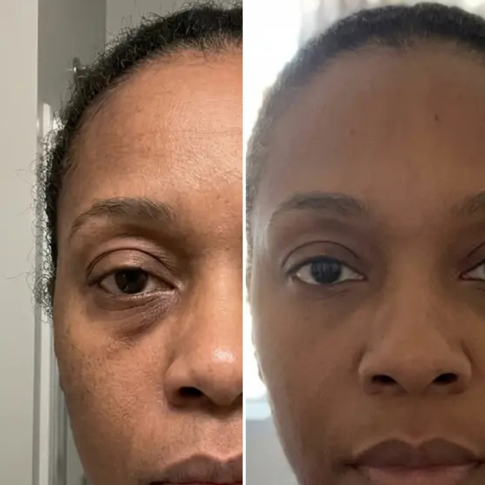 <h1>The Clear, Even Skin You've Been Waiting For</h1>