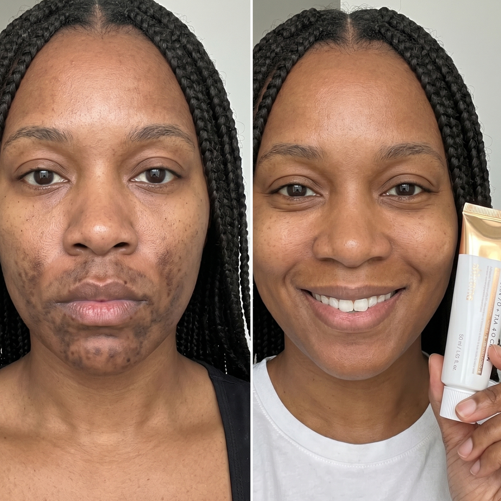 <h1>The Clear, Even Skin You've Been Waiting For</h1>