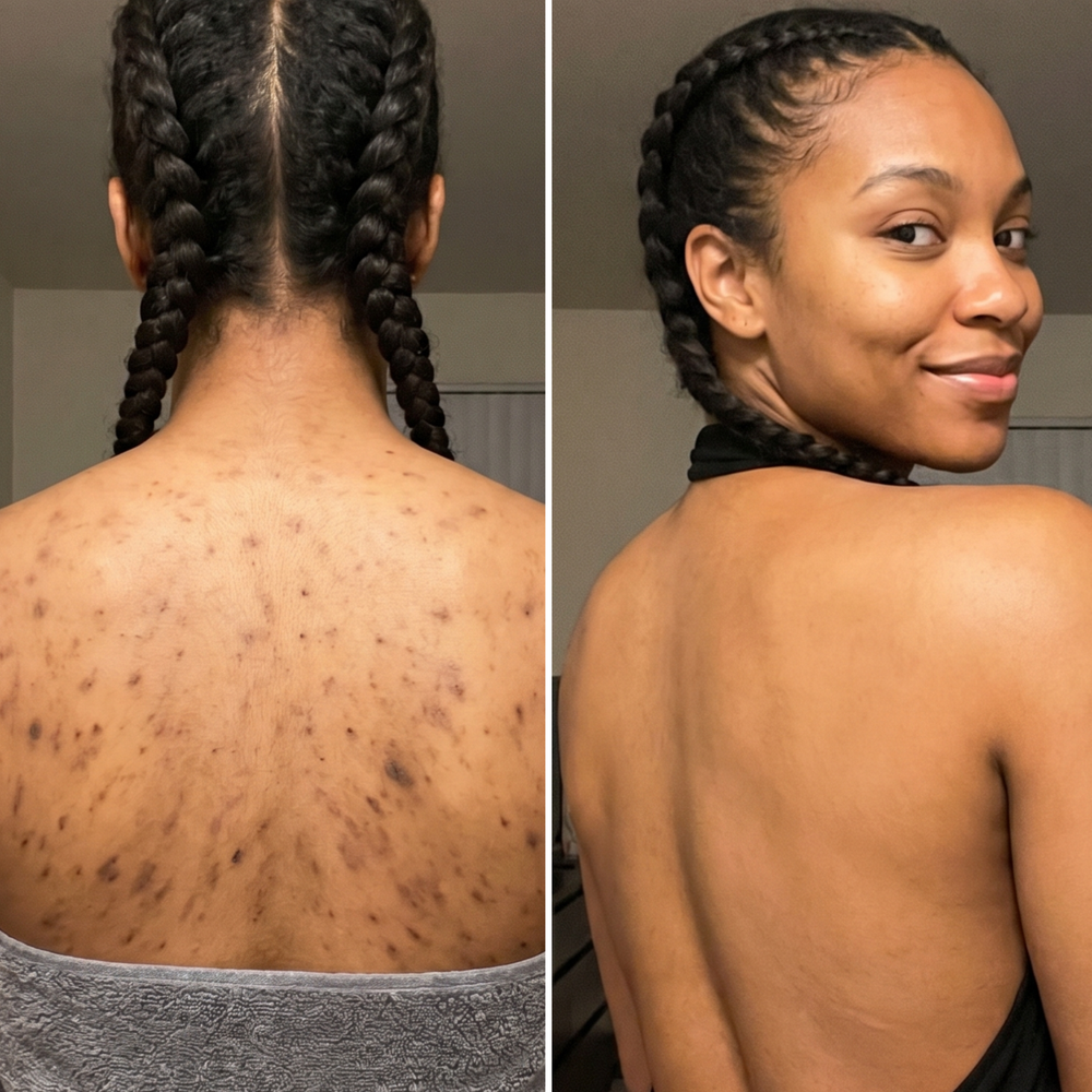 <h1>The Clear, Even Skin You've Been Waiting For</h1>