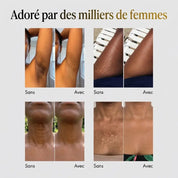 Shimma™ Perfecteur Corporel à l'Huile de Nigelle