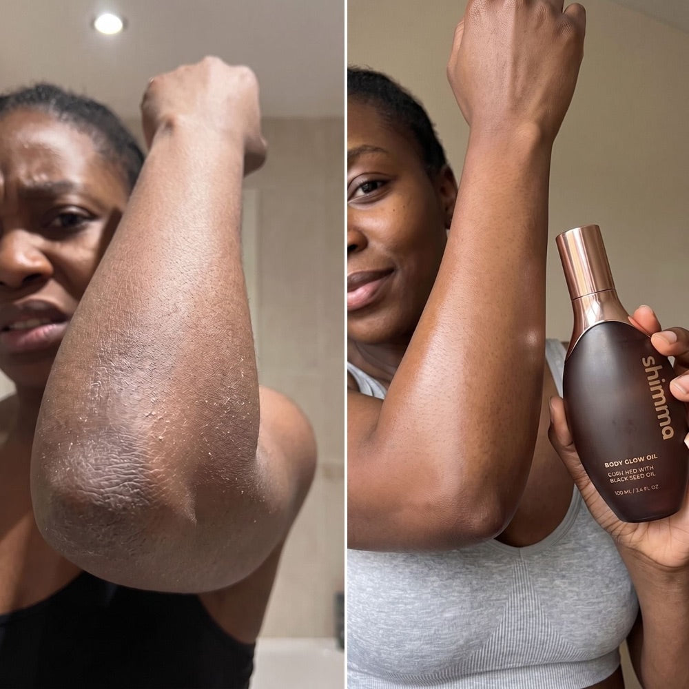 Michelle, 51